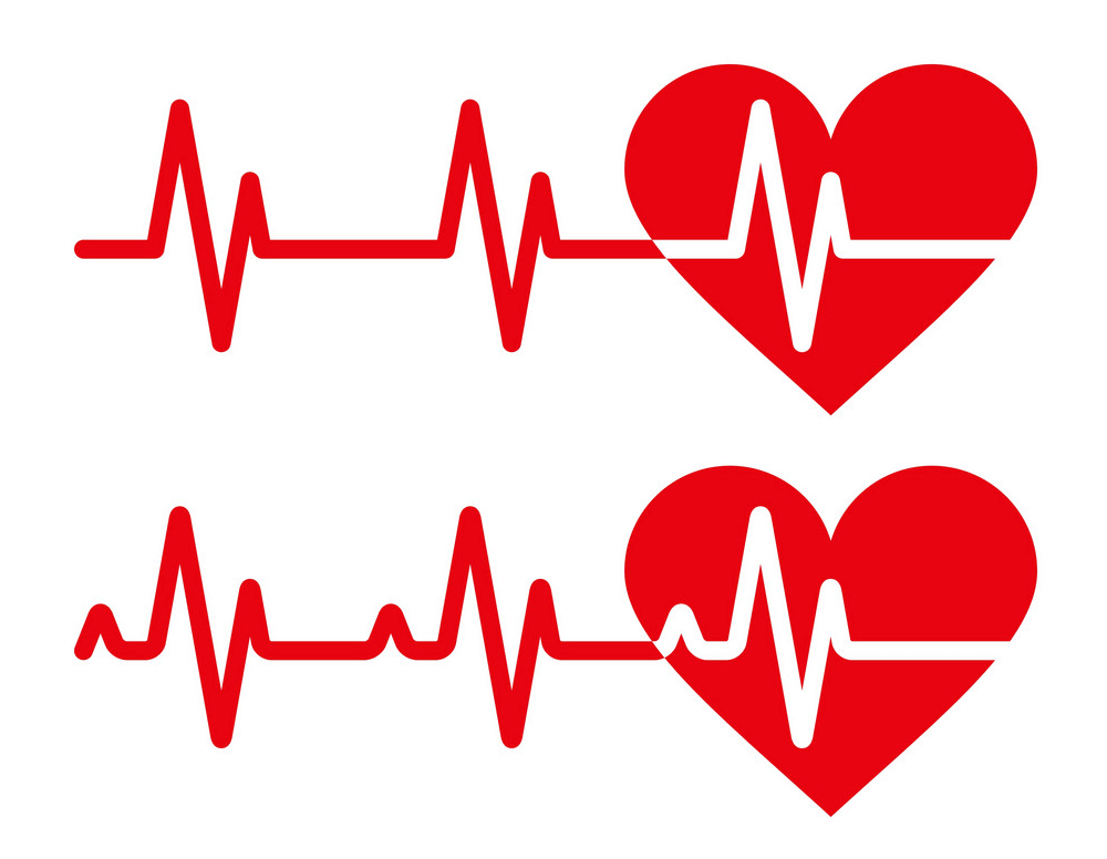 Heartbeat Icon clipart