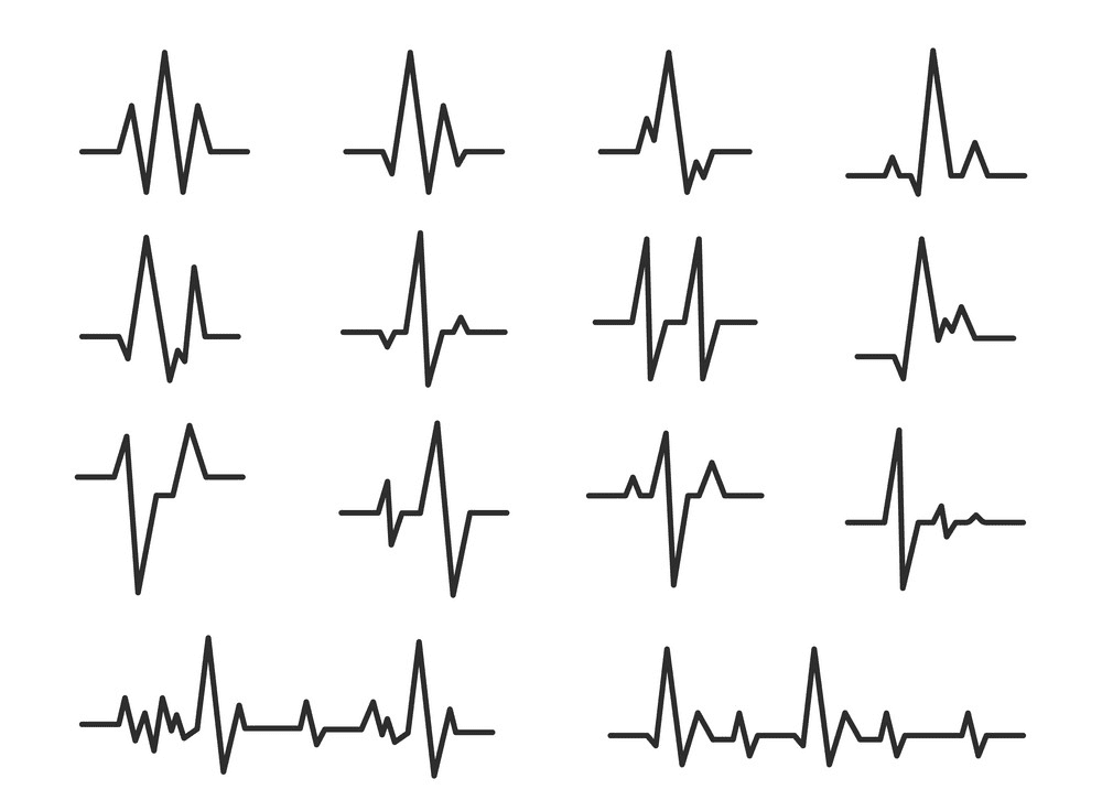 Heartbeat clipart free 1
