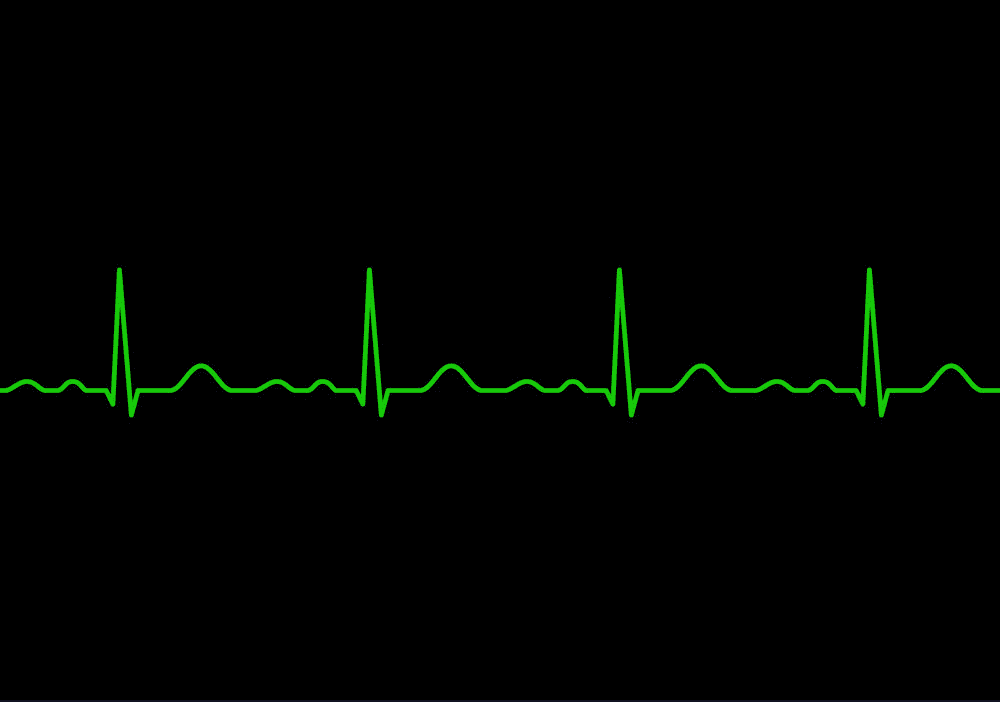 Heartbeat line clipart 6
