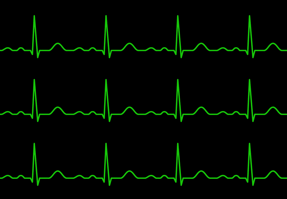 Heartbeat line clipart 7