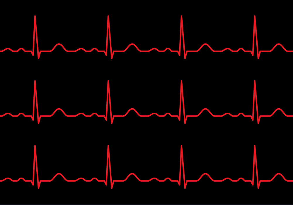 Heartbeat line clipart 8