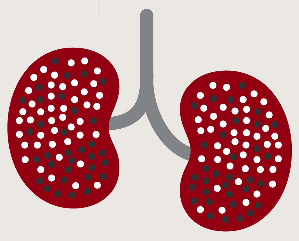 Kidney Clipart Pictures